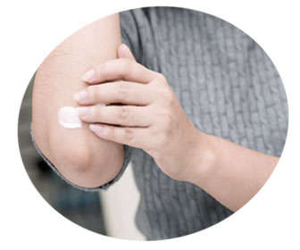 gel de arnica para las quemaduras